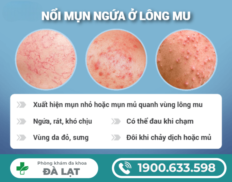 Hình ảnh minh họa